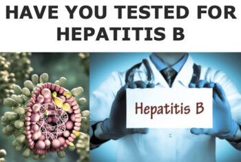 Have you tested for Hepatitis B