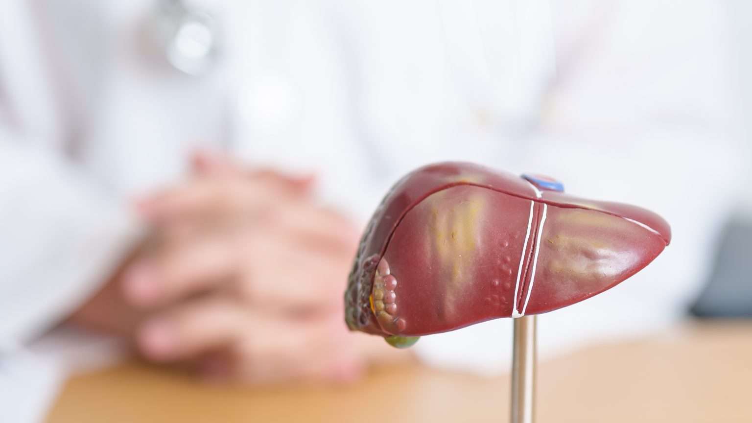 Resmetirom Reduces Liver, CV Risk Factors in NASH With Cirrhosis