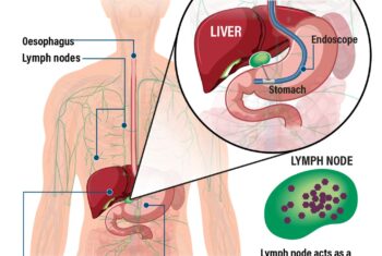 Scientists look to grow 'mini livers' for patients with organ damage