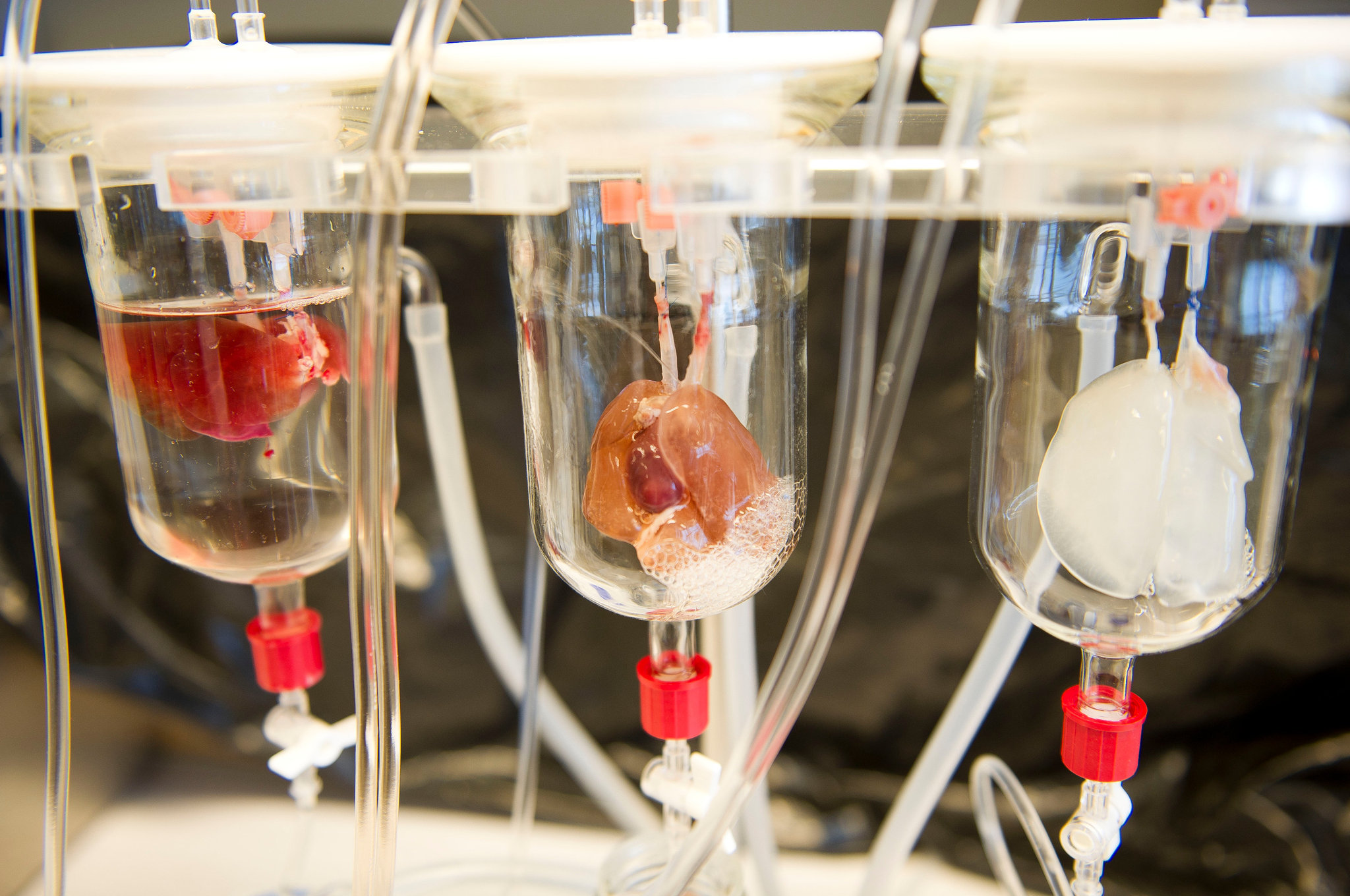 Scientists look to grow ‘mini livers’ for patients with organ damage