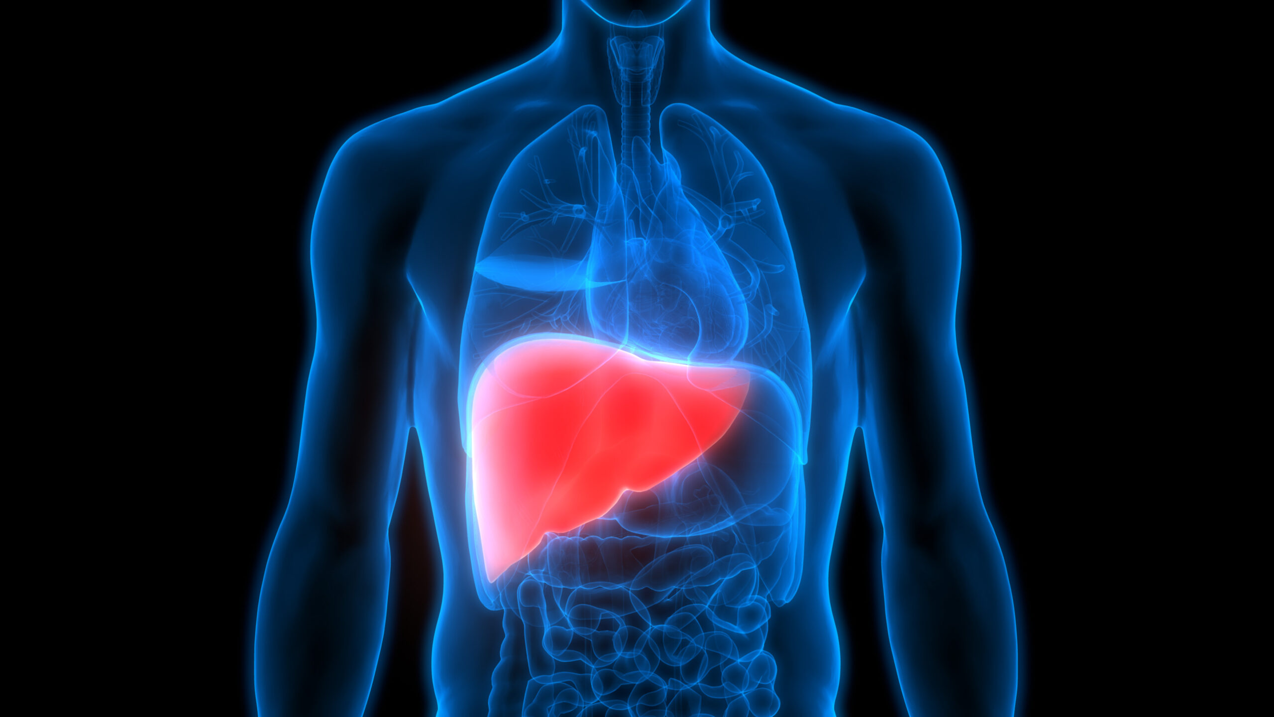 How is fatty liver detected