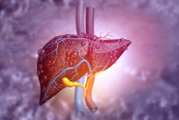 differentiate between simple fatty liver and NASH