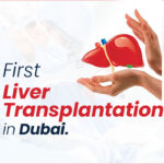 Liver Transplantation in Dubai