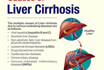 diseases cause liver fibrosis and cirrhosis
