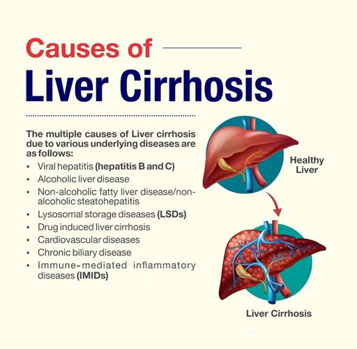 diseases cause liver fibrosis and cirrhosis