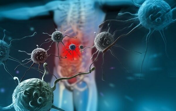 Autoimmune Hepatitis Dubai