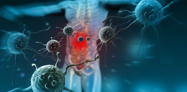 Autoimmune Hepatitis Dubai