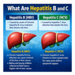 What Are Hepatitis B & C