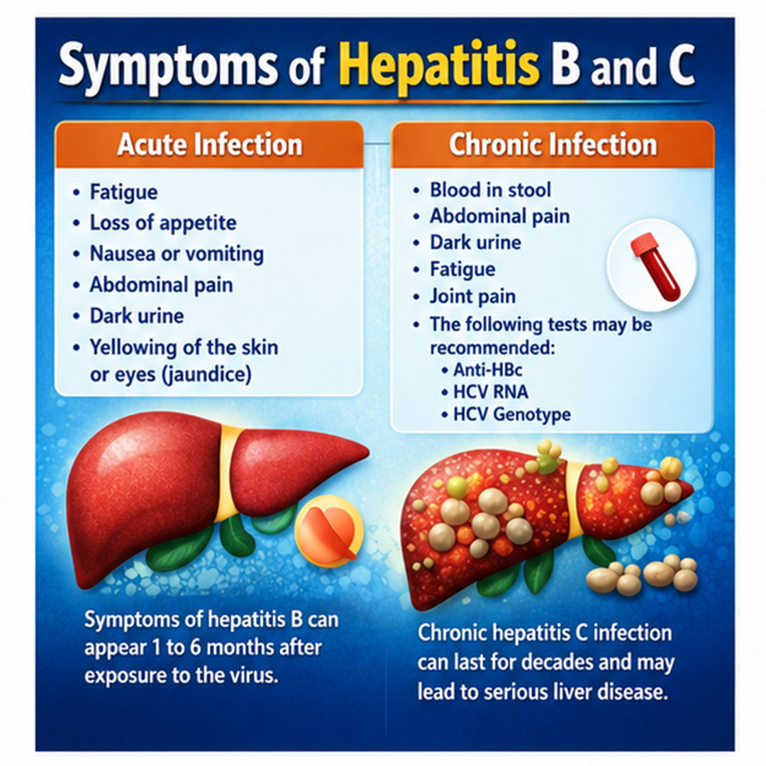Symptoms of Hepatitis B and C
