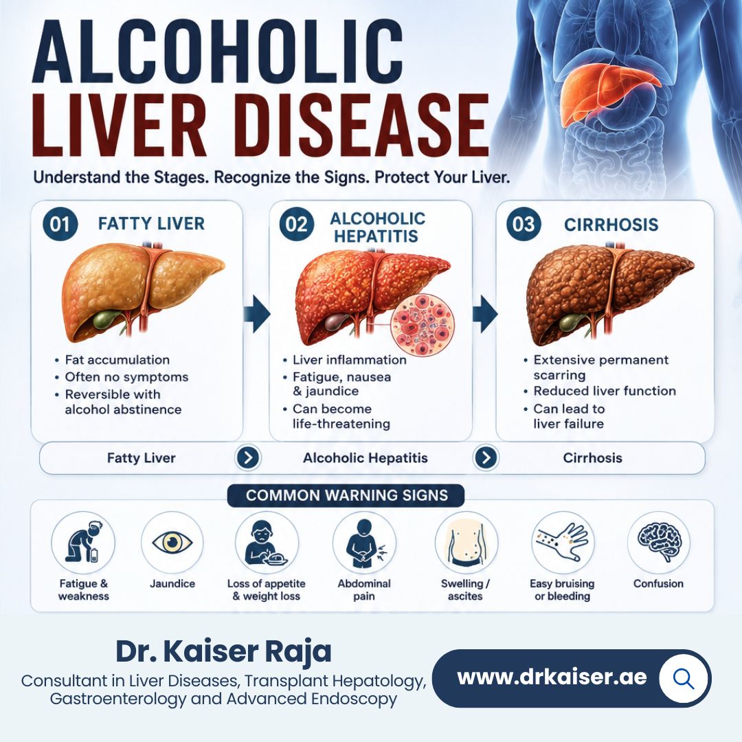 Alcoholic Liver Disease Treatment in Dubai