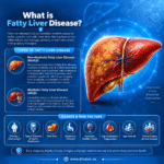 Fatty liver disease in Dubai